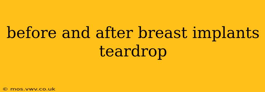 before and after breast implants teardrop