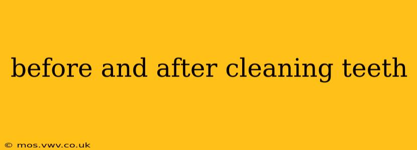 before and after cleaning teeth