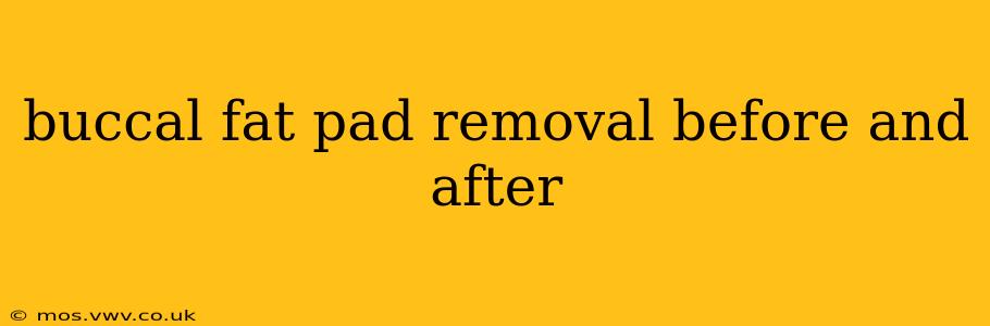 buccal fat pad removal before and after