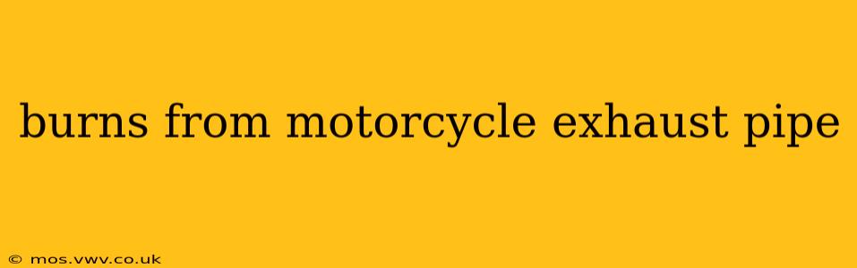 burns from motorcycle exhaust pipe