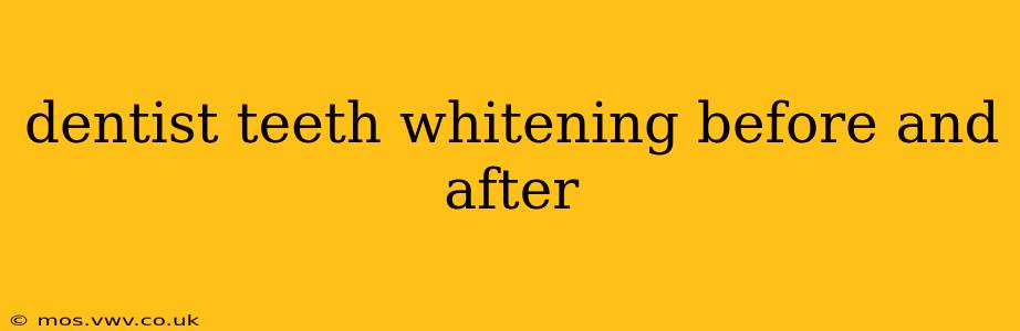dentist teeth whitening before and after