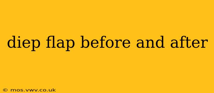 diep flap before and after