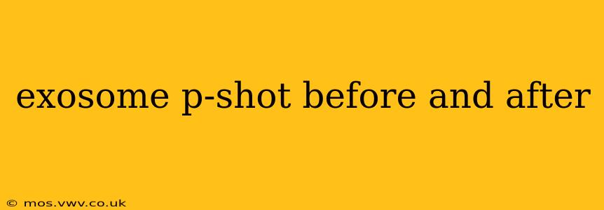 exosome p-shot before and after
