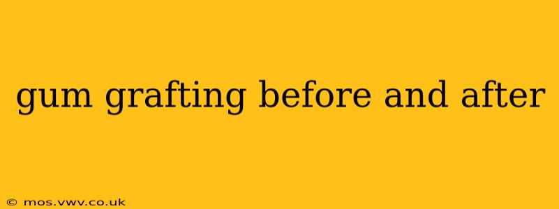 gum grafting before and after