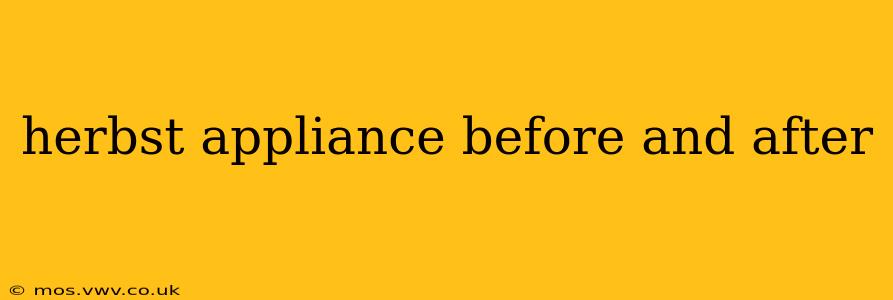 herbst appliance before and after