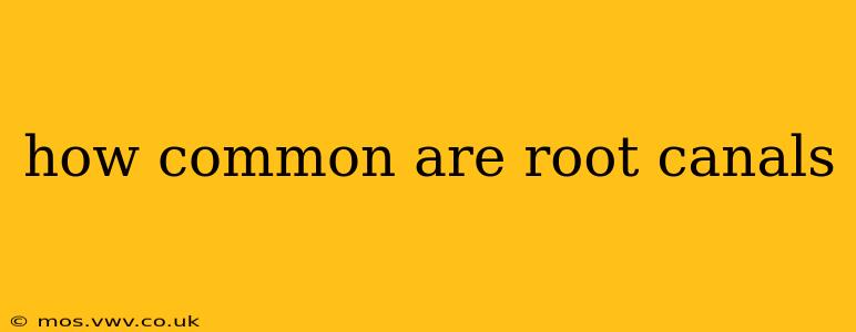 how common are root canals