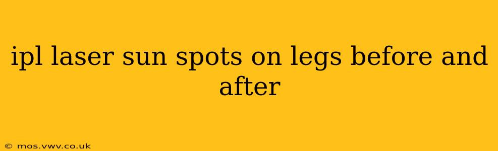 ipl laser sun spots on legs before and after