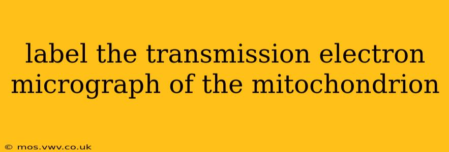 label the transmission electron micrograph of the mitochondrion