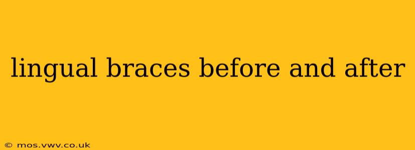 lingual braces before and after