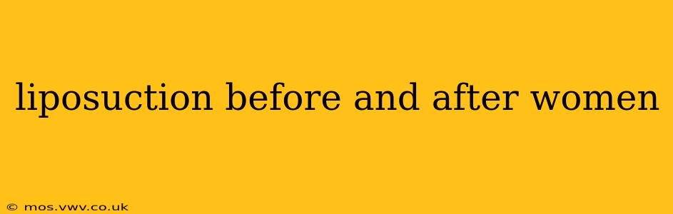 liposuction before and after women