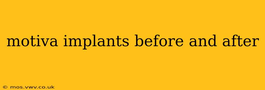 motiva implants before and after