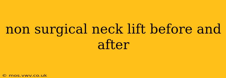 non surgical neck lift before and after