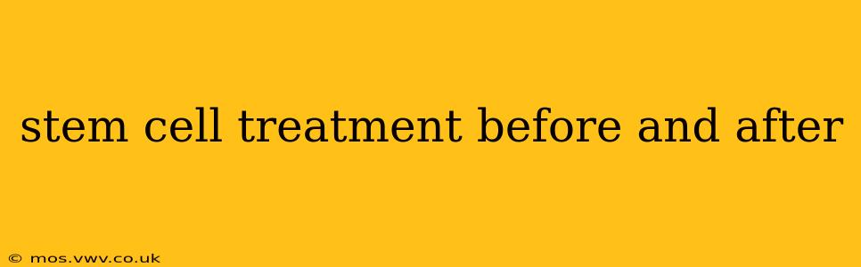 stem cell treatment before and after