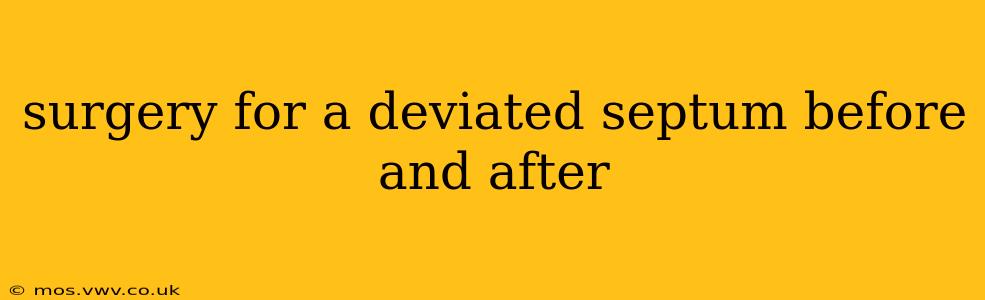 surgery for a deviated septum before and after