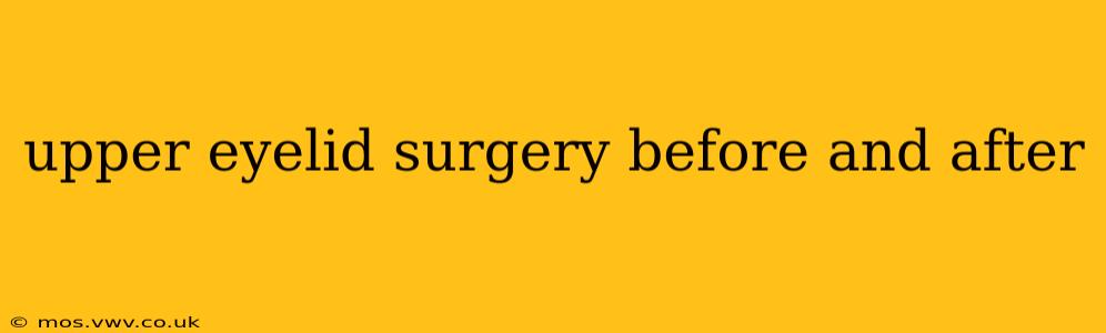 upper eyelid surgery before and after