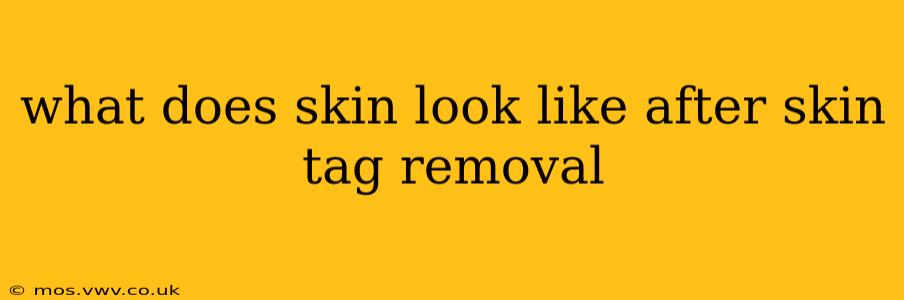 what does skin look like after skin tag removal