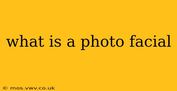 what is a photo facial