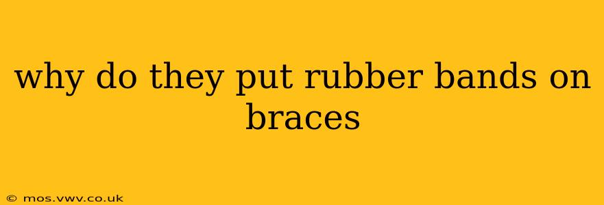 why do they put rubber bands on braces
